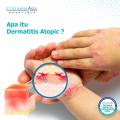 Apa Itu Dermatitis Atopik?