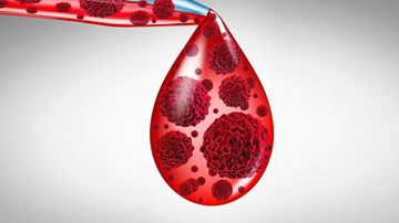 Columbia Asia Hospital - Health Article - Five Blood Cancer Myths