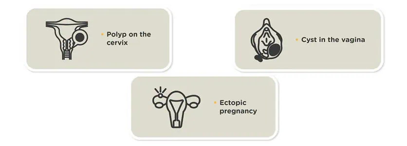 Myths & Old Wives Tales About Pregnancy: Revealed - Columbia Asia