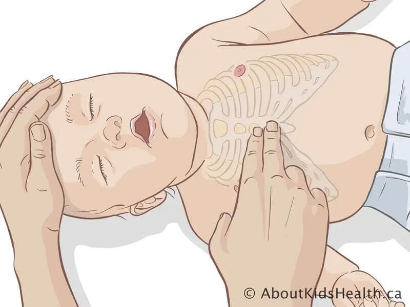 Lakukan tekanan dada (chest thrust) dengan menekan dua jari di tengah dada bayi sebagai sebahagian daripada pertolongan kecemasan.