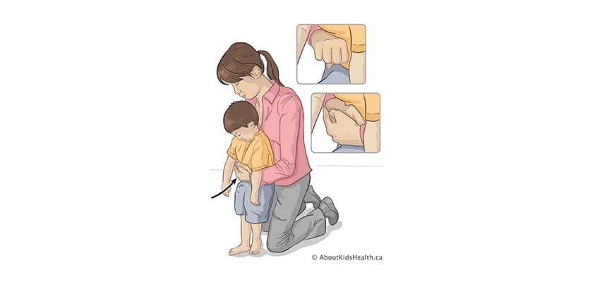 Untuk kanak-kanak berumur lebih 1 tahun, lakukan Heimlich Maneuver untuk mengeluarkan makanan/objek yang menyekat saluran pernafasan.
