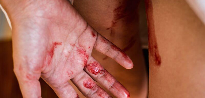 Pendarahan ketika hamil, salah satu gejala yang sering berlaku apabila uri berada terlalu rendah dan menghadang laluan bayi