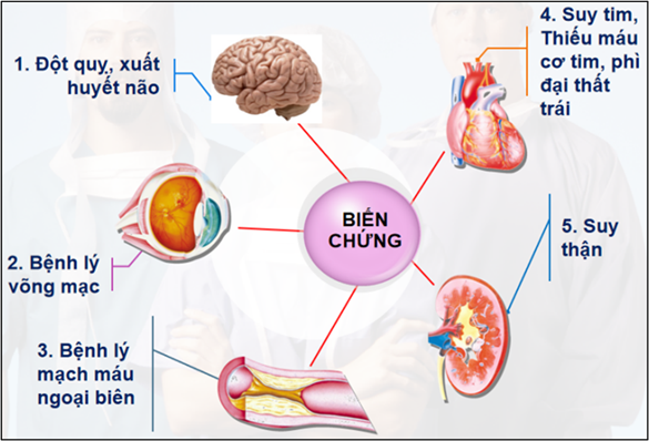 Những điều cần biết về tăng huyết áp | Columbia Asia Hospital - Vietnam